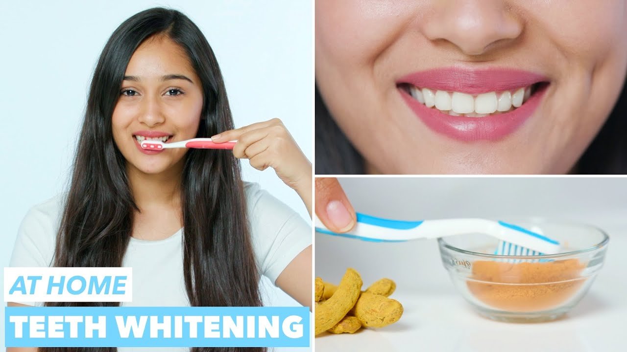 Teeth Whitening Home Remedies
